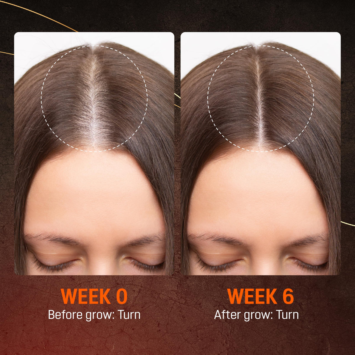 ABERA beard application image showing targeted use for fuller facial hair
