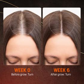 ABERA beard application image showing targeted use for fuller facial hair