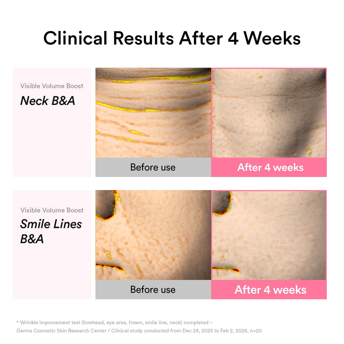 Abib applying booster to neck showing improved firmness benefit