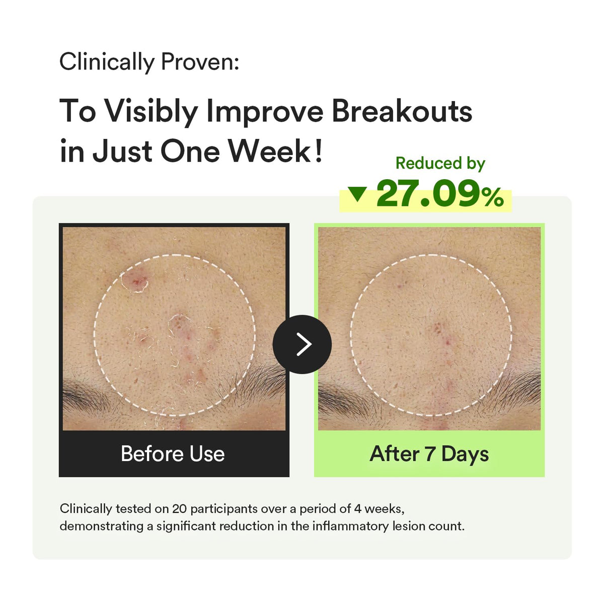Abib visible oil capsules close-up showing targeted delivery of calming actives