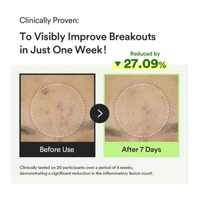 Abib visible oil capsules close-up showing targeted delivery of calming actives