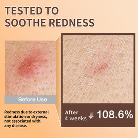 ABOTE dropper dispensing serum for precise application and less waste