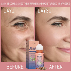 abyst cuticles and hands using roll on for quick moisturizing relief