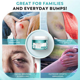 ACLINK being applied under eye to soothe bruising and swelling