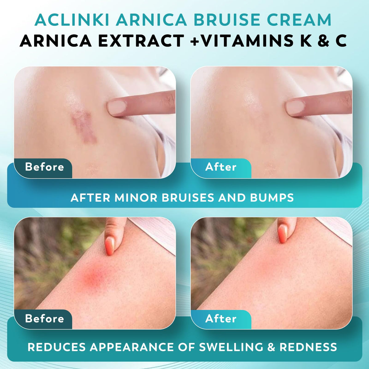 ACLINK display of botanicals like horse chestnut and aloe vera benefits