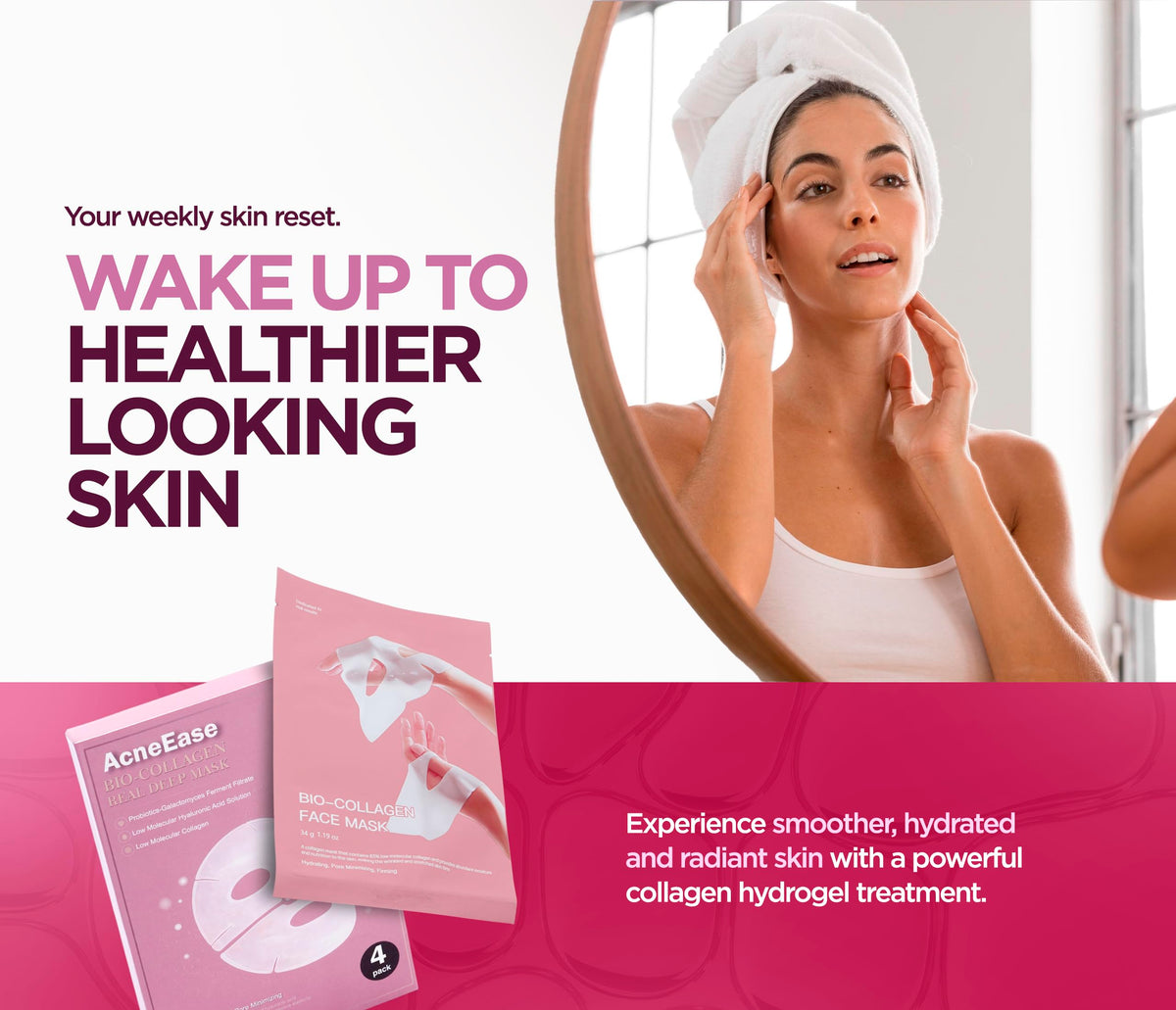 AcneEase on bathroom shelf in lifestyle scene promoting routine use