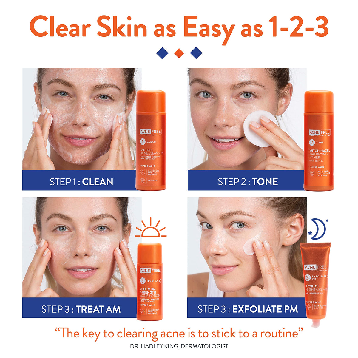 AcneFree 10% benzoyl peroxide lotion pump showing treatment strength for blemishes
