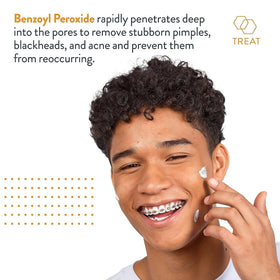 AcneFree pack of three tubes showing value and multiple supply benefit