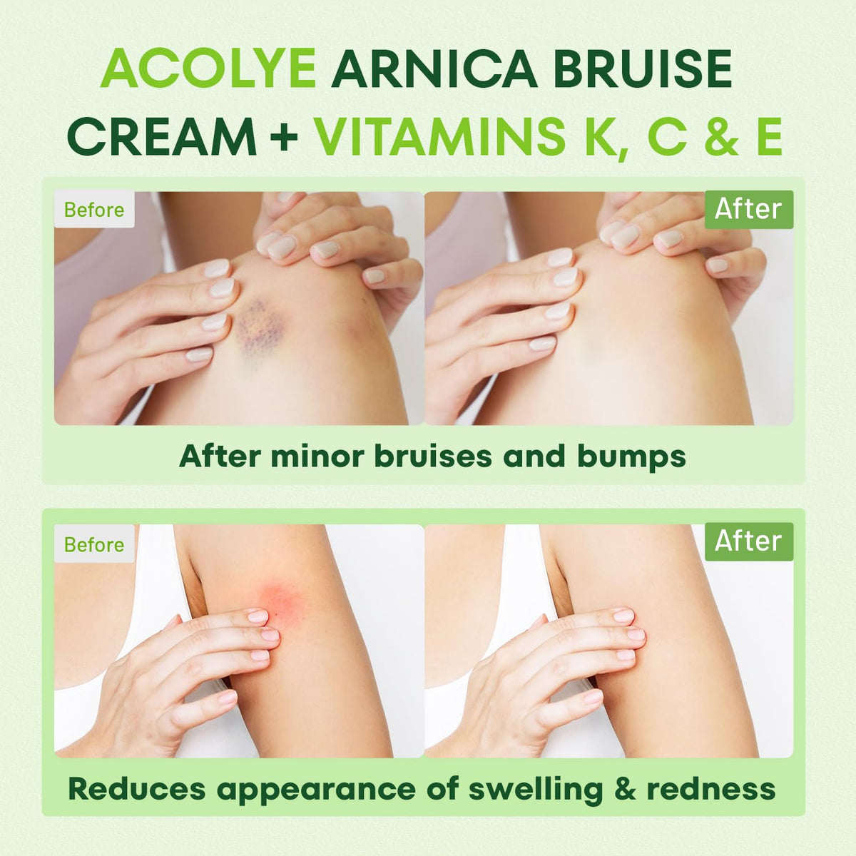 Acolye tube held next to hand for size comparison and travel-friendly benefit
