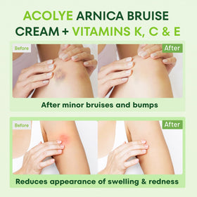 Acolye tube held next to hand for size comparison and travel-friendly benefit