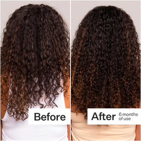 ACT+ ACRE applied to scalp demonstrating targeted application and improved scalp hydration benefit