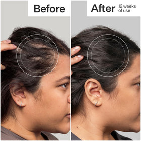 Act+ Acre before and after styled hair visual suggesting fuller‑looking results over time