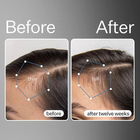 ACT+ ACRE pipette close-up dispensing serum for precise, mess-free application benefit