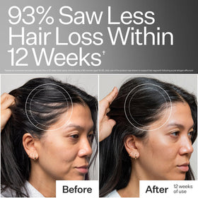 Act+ Acre scalp application in use illustrating daily massage technique and improved coverage