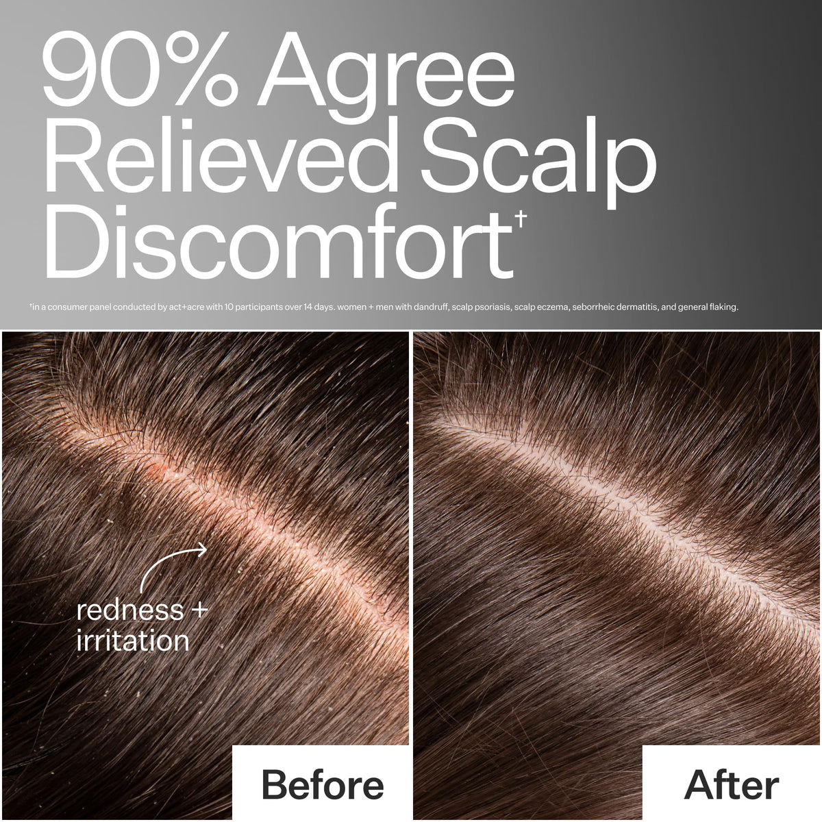 ACT+ ACRE close-up of serum texture highlighting lightweight absorption
