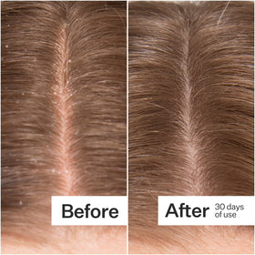 ACT+ ACRE ingredient label with Amino M3 Complex and botanical extracts