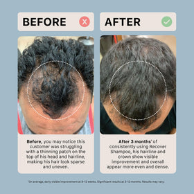ACTIIV shampoo in shower being applied showing cleansing benefit