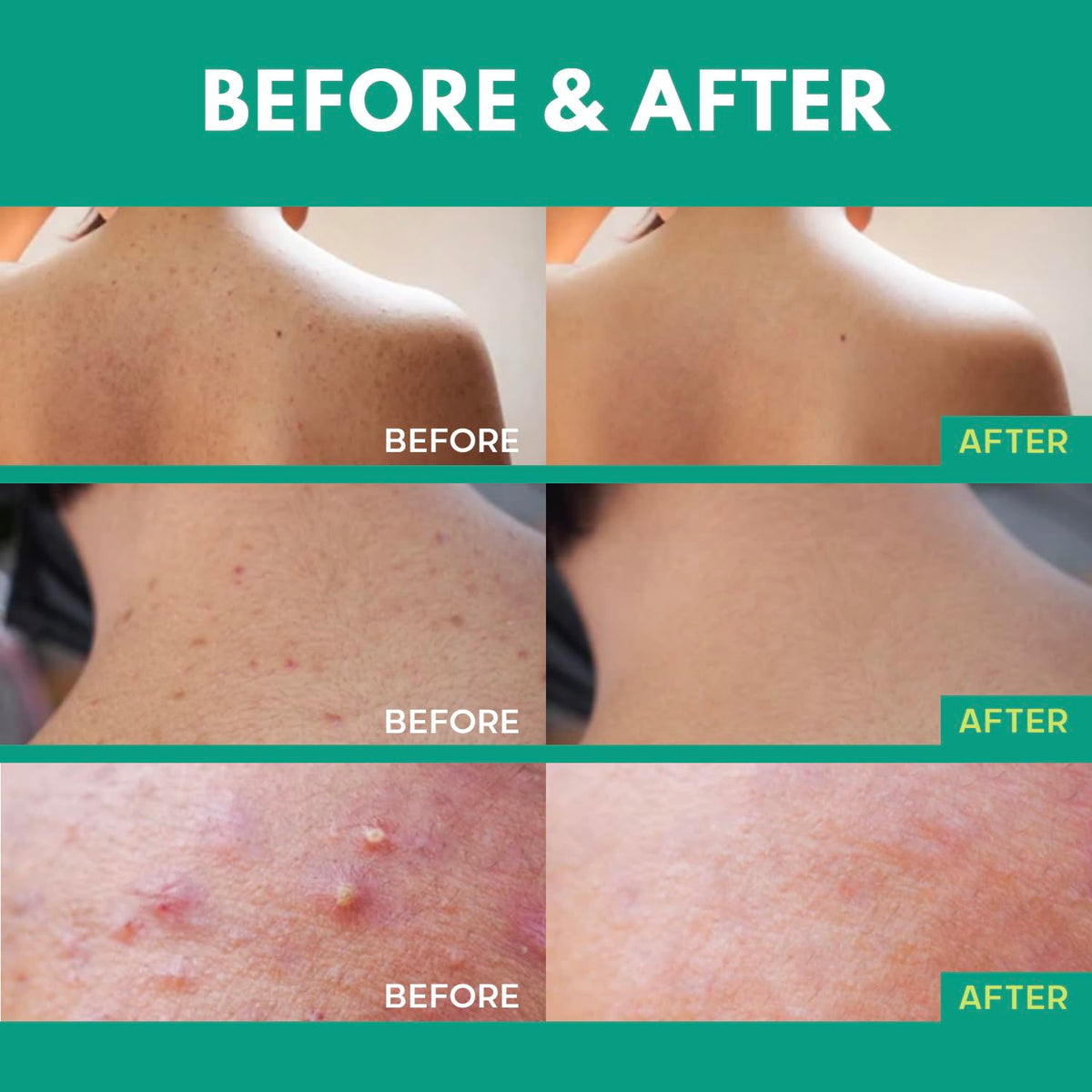 Adellina ingredient label detail highlighting salicylic acid and botanical extracts for clarity