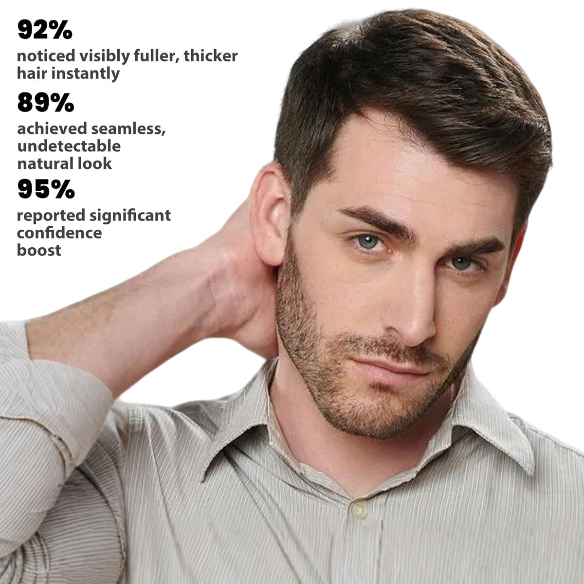 Adglamful fibers applied to hairline showing concealed sparse areas and natural finish