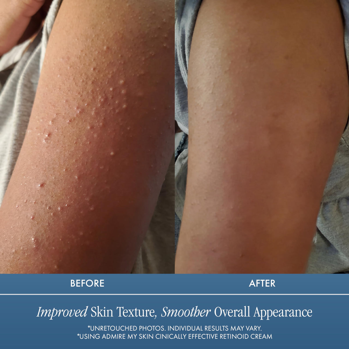 Admire My Skin ingredient label detail highlighting key actives