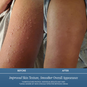 Admire My Skin ingredient label detail highlighting key actives