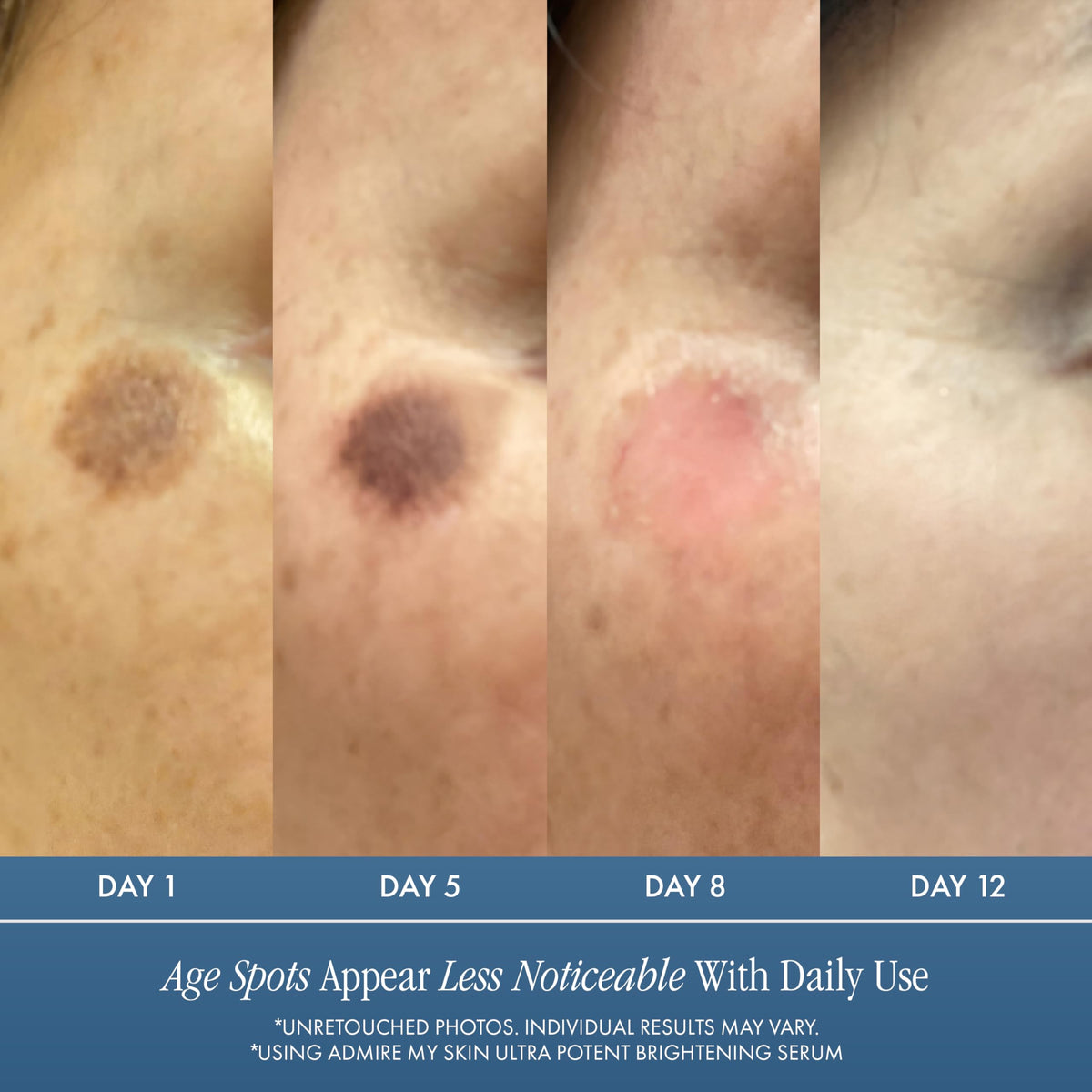 Admire My Skin label close-up listing Synovea HR and acids for ingredient clarity