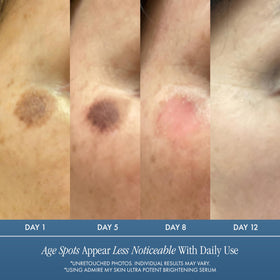 Admire My Skin label close-up listing Synovea HR and acids for ingredient clarity