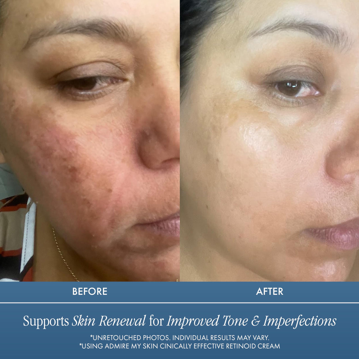 Admire My Skin jar open revealing cream texture and easy scoop benefit