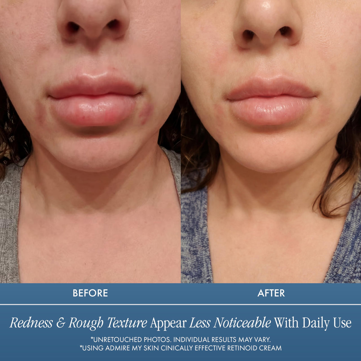 Admire My Skin close-up of smooth cream texture for fast absorption