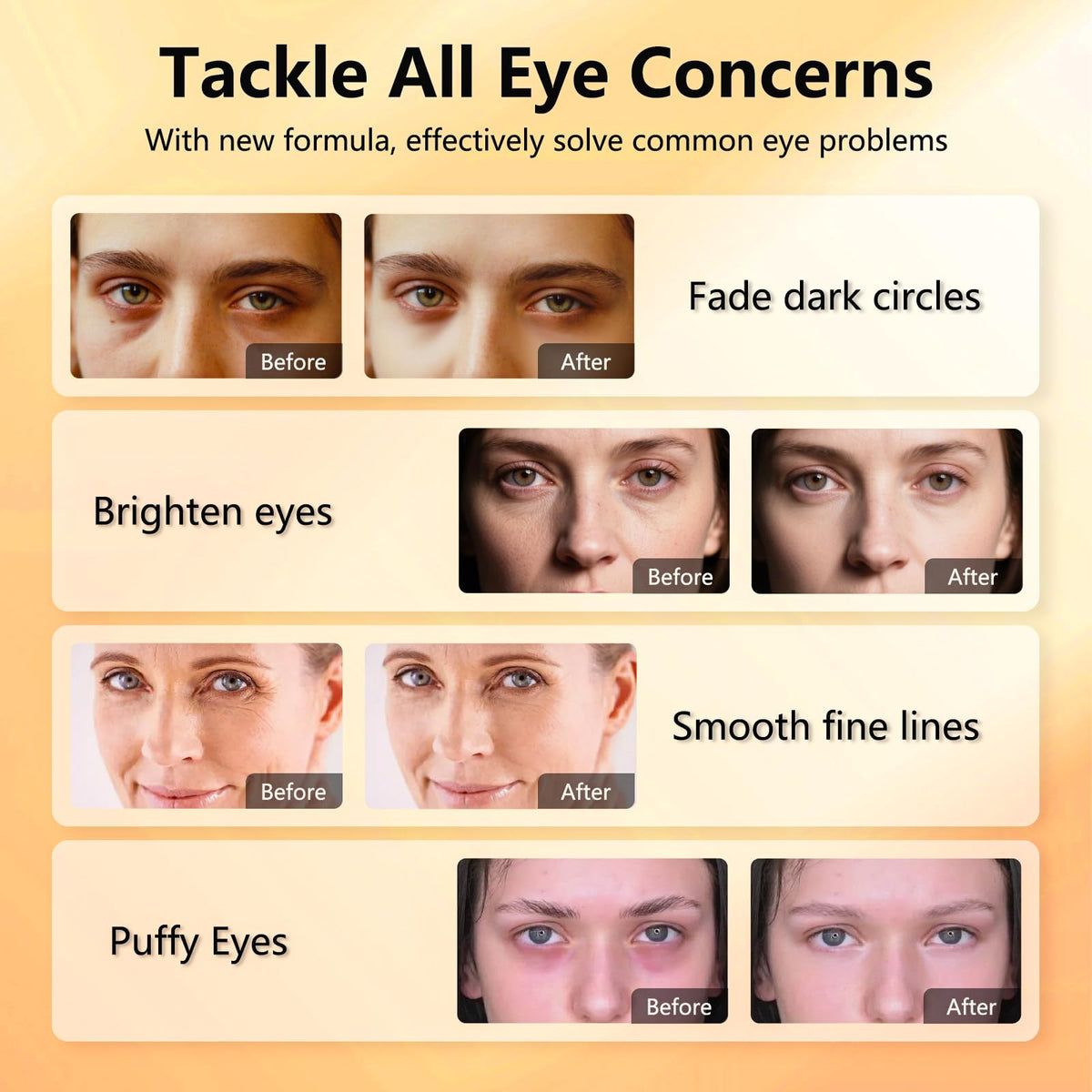 Aeryea patch applied under-eye demonstrating de-puffing and targeted hydration