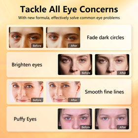 Aeryea patch applied under-eye demonstrating de-puffing and targeted hydration