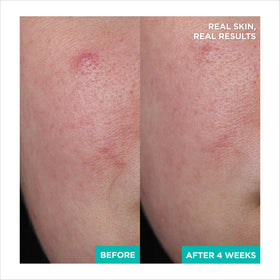 AESTURA product being smoothed on hand to show fast absorption