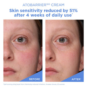 AESTURA applying cream to hand illustrating immediate comfort benefit