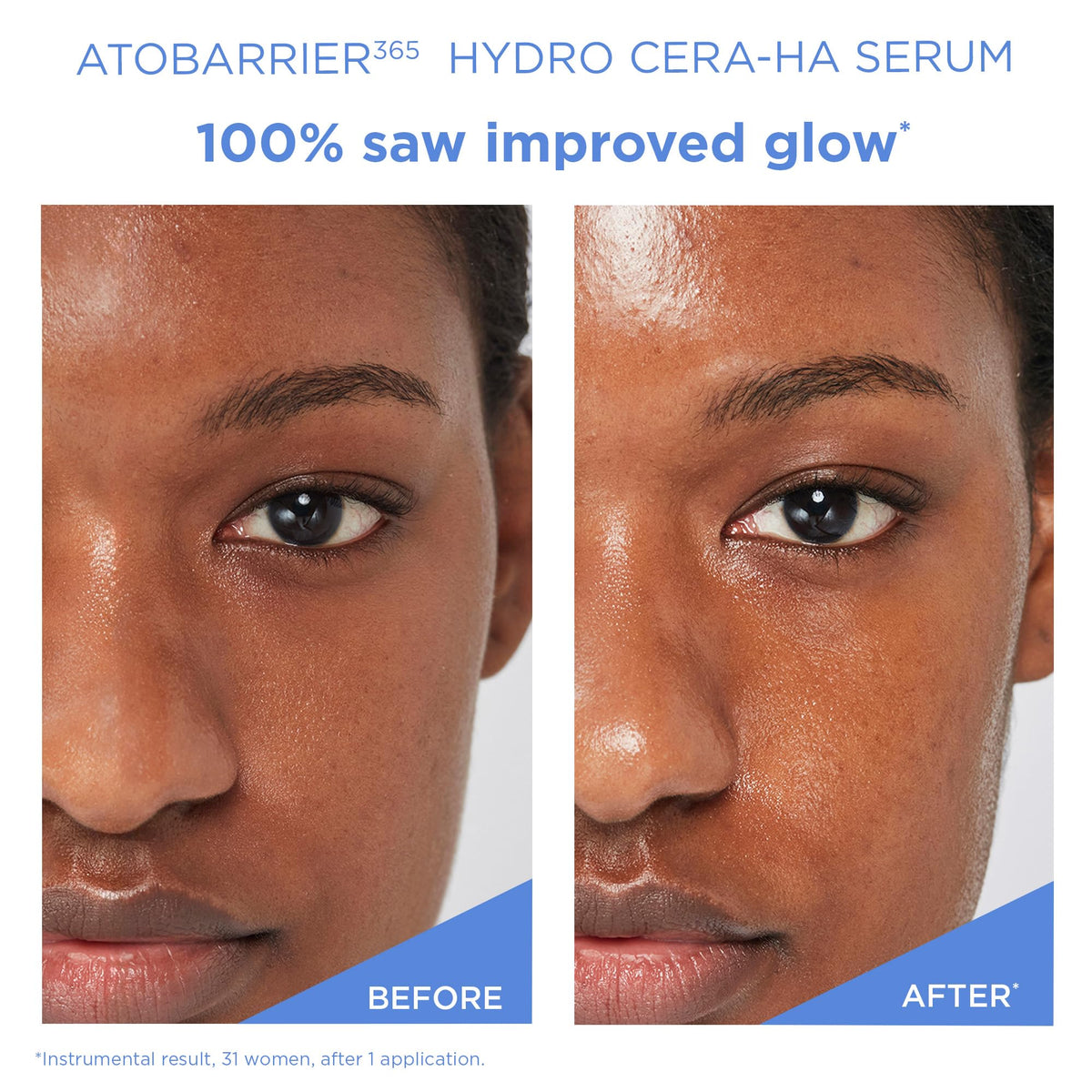 AESTURA applying serum to cheek, conveys calming hydration benefit