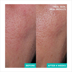 AESTURA pad soaked with clear serum dripping to show hydrating hyaluronic benefit