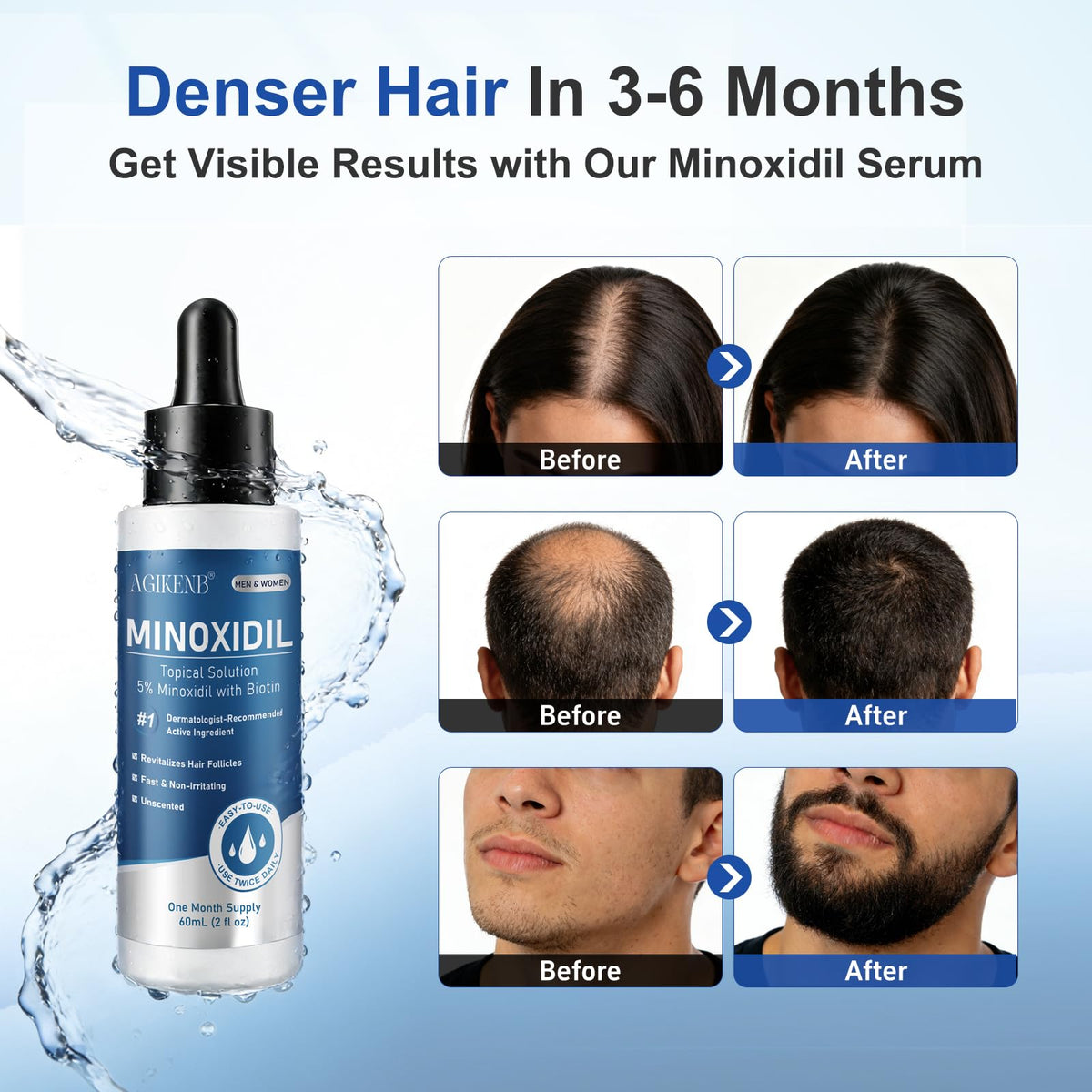 AGIKENB bottle applying solution to scalp showing targeted coverage