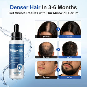 AGIKENB bottle applying solution to scalp showing targeted coverage