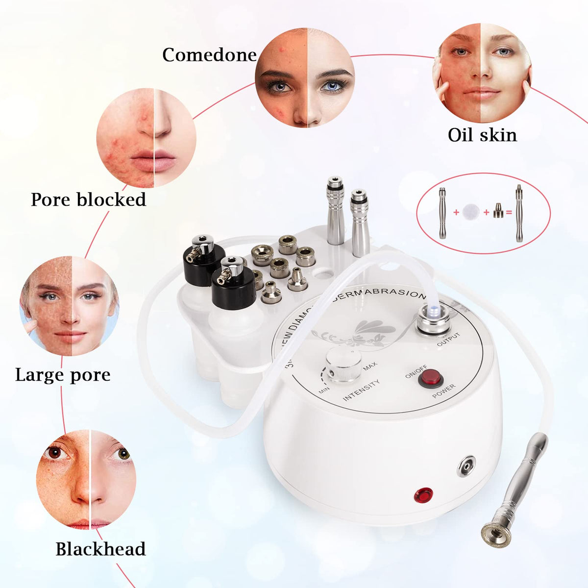 Close-up of AIMENGXI diamond tips highlighting sterile texture for precise exfoliation