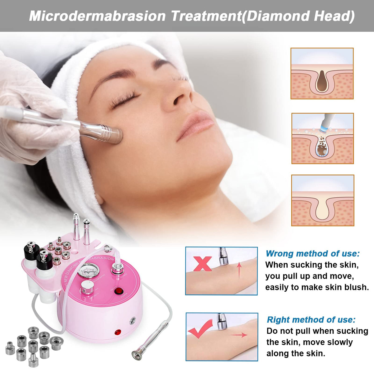 AIMENGXI handpiece close-up showing tip connection for controlled dermabrasion