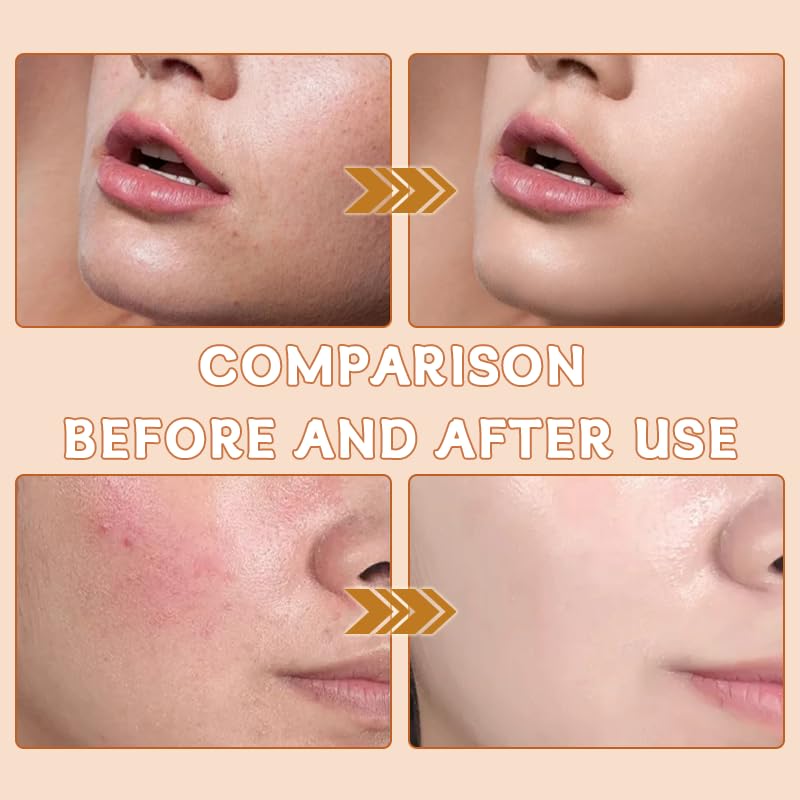 Aiwejay Hanae Korea applying under-eye area showing precision and brightening effect