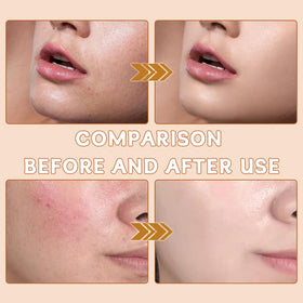 Aiwejay Hanae Korea applying under-eye area showing precision and brightening effect