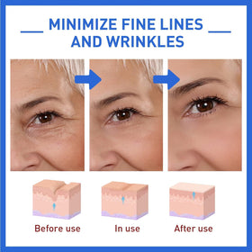 AKEASS applying serum to cheek for firmer-looking skin benefit