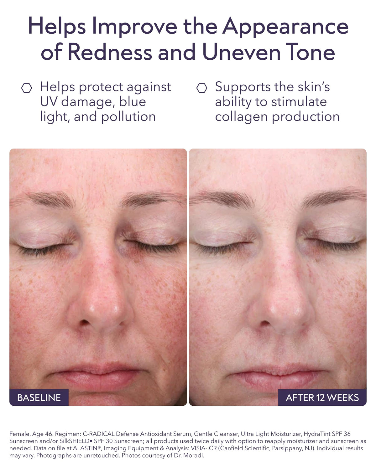 ALASTIN C-RADICAL dropper dispensing serum demonstrating precise application