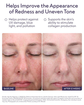 ALASTIN C-RADICAL dropper dispensing serum demonstrating precise application