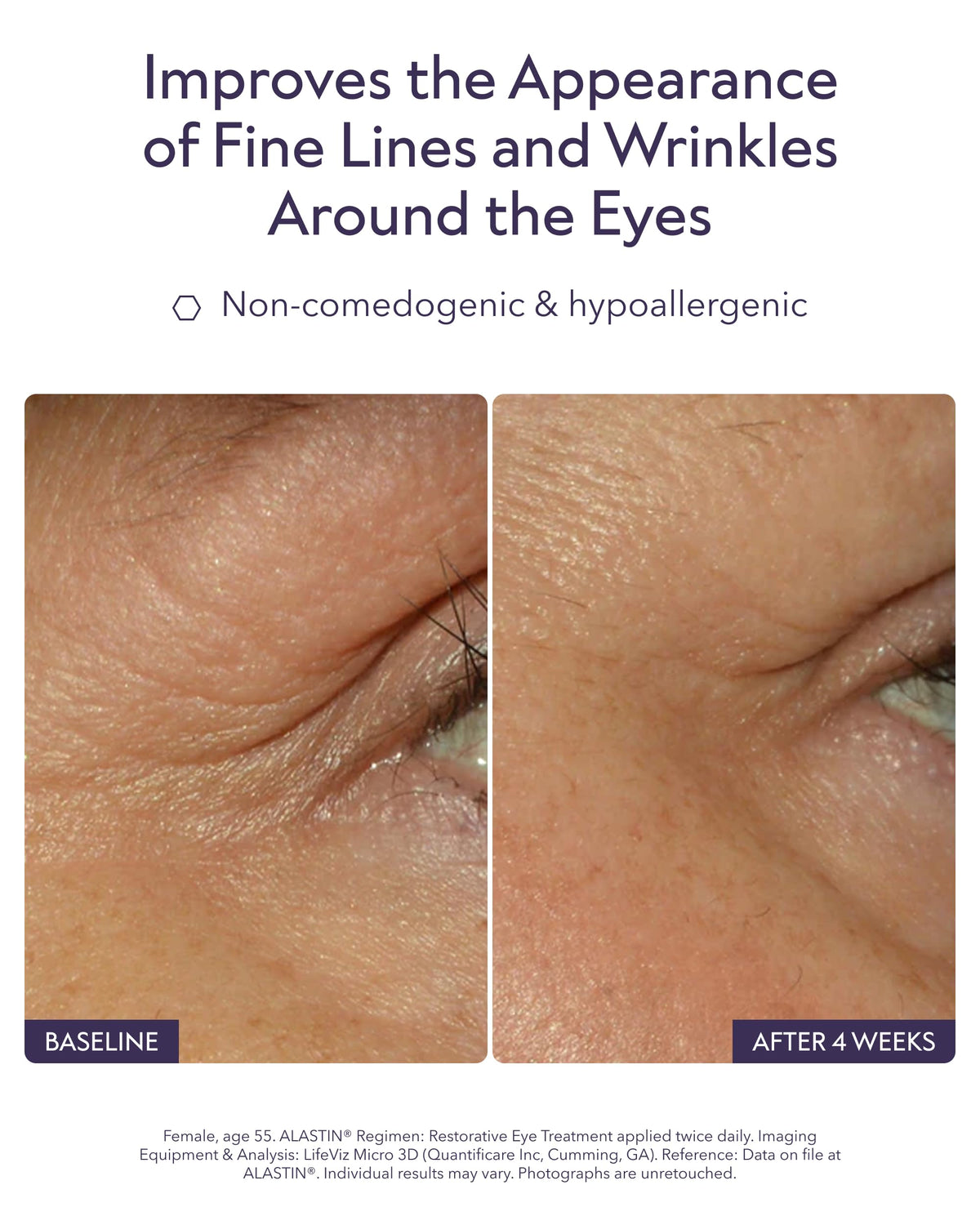 ALASTIN Skincare applicator tip detail for precise under-eye application