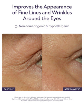 ALASTIN Skincare applicator tip detail for precise under-eye application