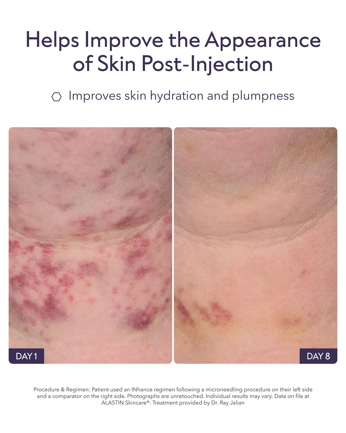ALASTIN Skincare INhance gel-serum texture droplet demonstrating lightweight hydration