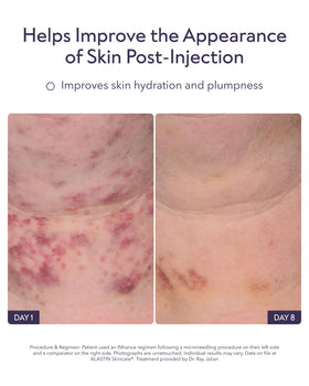 ALASTIN Skincare INhance gel-serum texture droplet demonstrating lightweight hydration