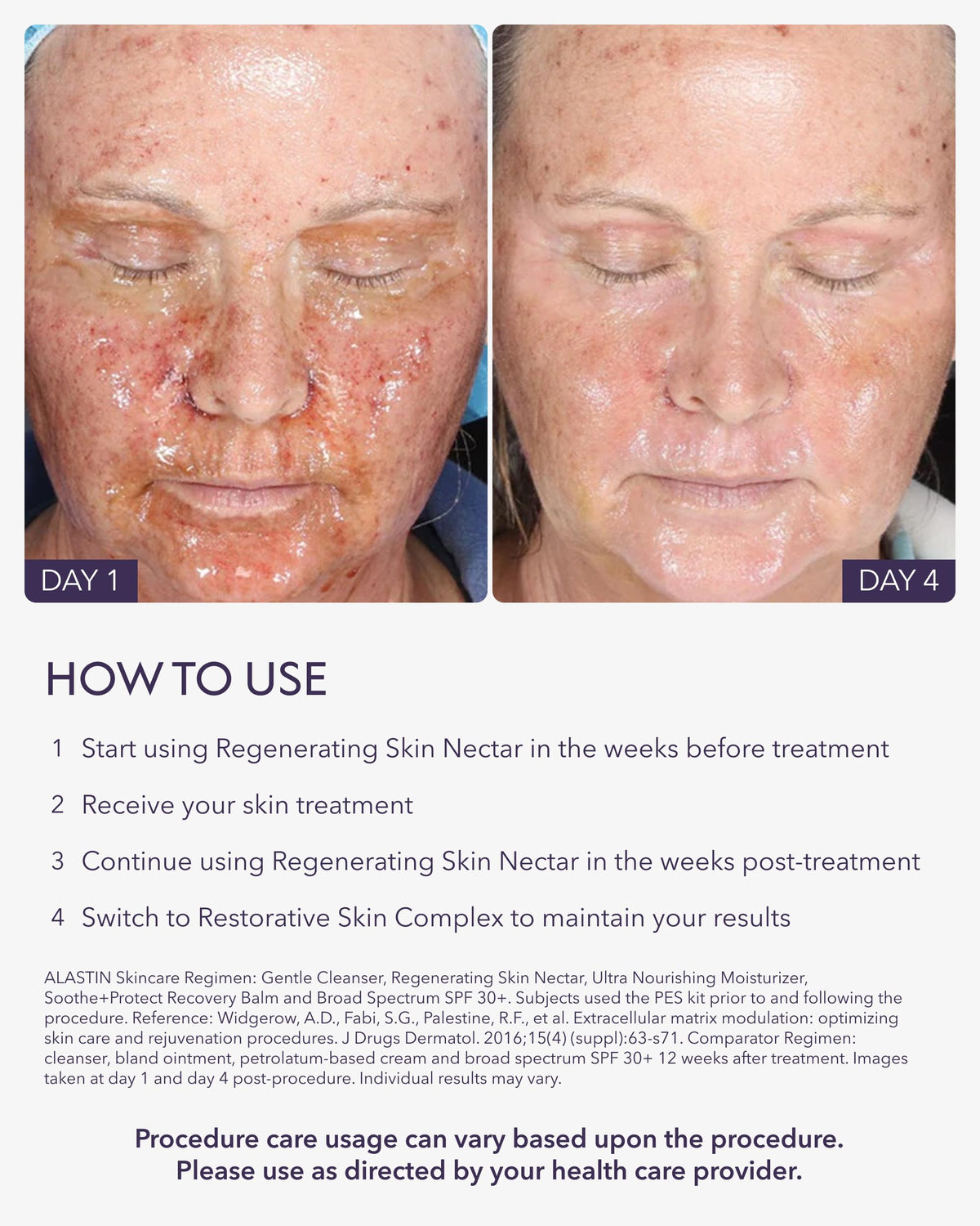ALASTIN Skincare label closeup showing key actives like TriHex Technology for support