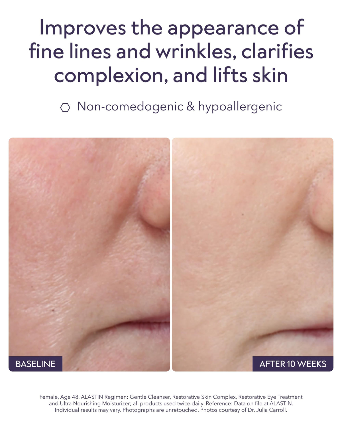 ALASTIN Skincare pump dispensing recommended amount for efficient coverage